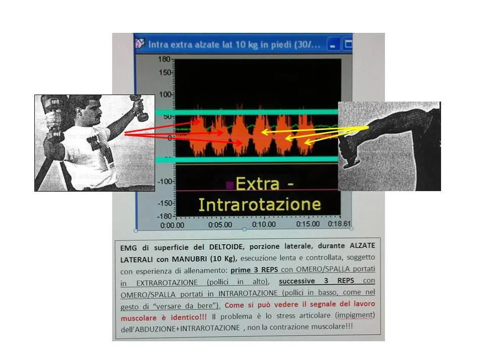 cuffia dei rotatori e body building