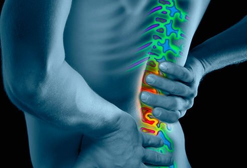 Mal di schiena e dolore lombare – Rimedi, prevenzione