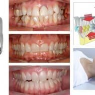 Occlusione dentale, postura e mal di schiena